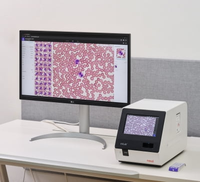 노을, AI 혈액분석 장비 성능 공개..."높은 정확성 확보"