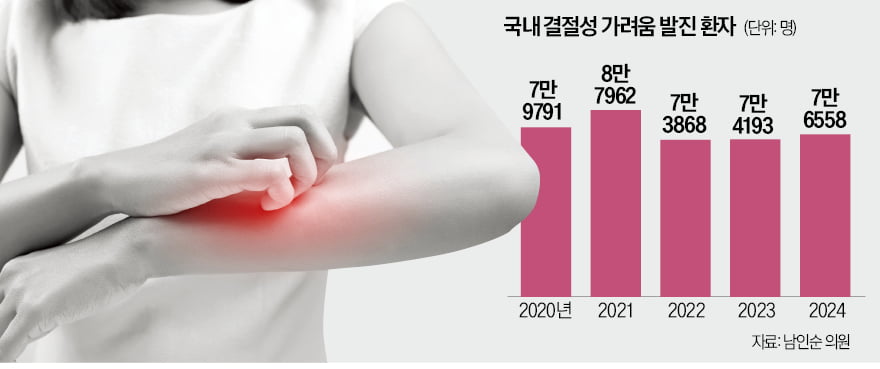극심한 가려움에 환자 60%가 수면장애…치료제 도입 절실