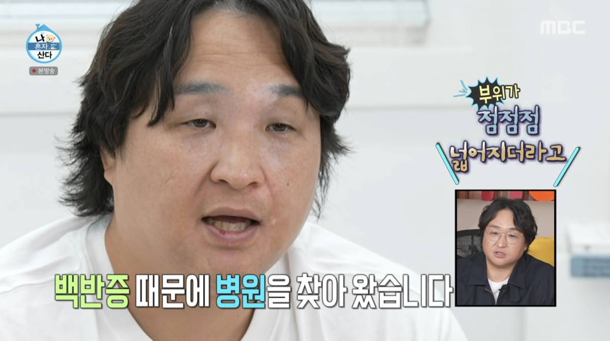 Actor Ku Sung-hwan Opens Up About Vitiligo Struggles on 'I Live Alone'