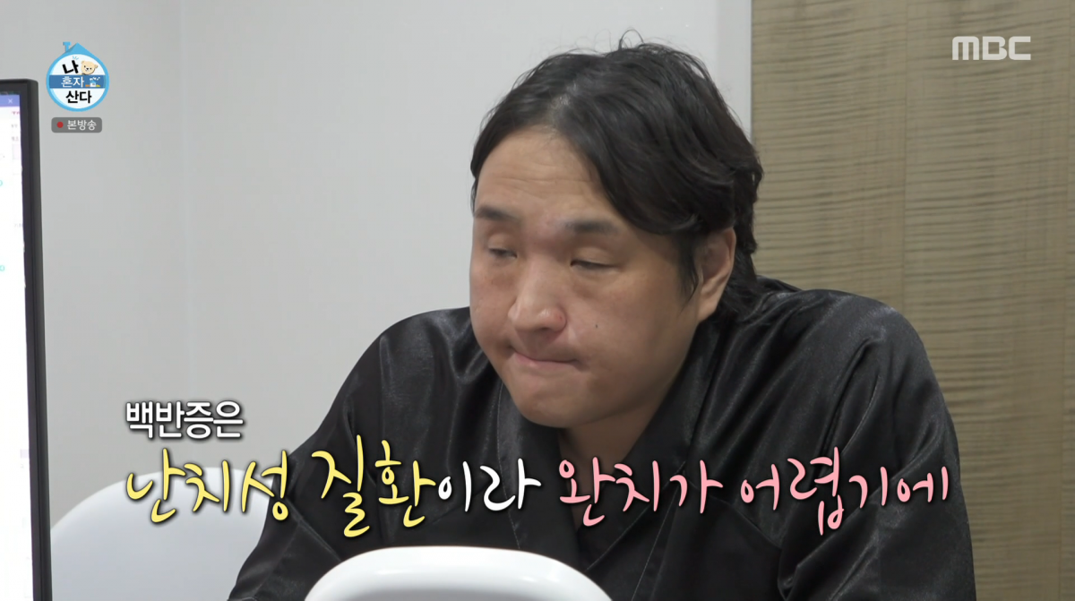 Actor Ku Sung-hwan Opens Up About Vitiligo Struggles on 'I Live Alone'