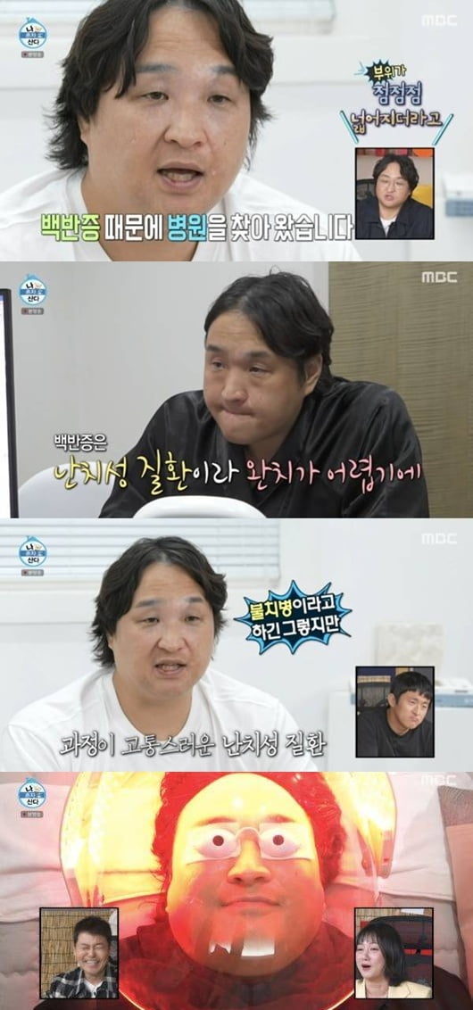 Actor Koo Sung-hwan Opens Up About Vitiligo Battle on 'I Live Alone'