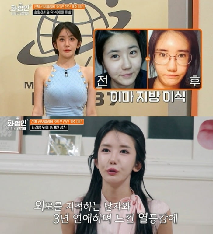 Woman Undergoes Over 400 Cosmetic Procedures, Investing Over $300,000