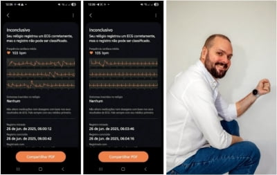 "갤럭시 워치 덕분에 살아"…브라질 남성, 구사일생