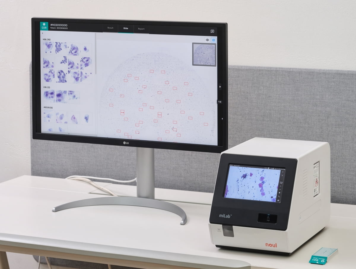 노을, 유럽 대표 유통사 뚫었다…자궁경부암 진단제품 독점 공급 계약