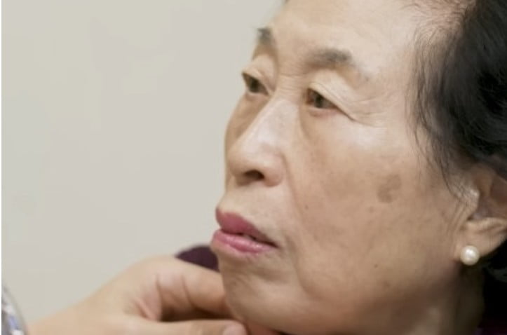 "안면거상·지방이식·쌍커풀·코"…전원주, 3000만원 성형수술 견적