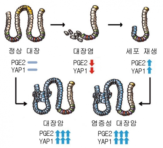 [그림]_새로_발견된_대장암_발병_기전.jpg